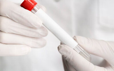 O que é o PSA (Antígeno Prostático Específico)?